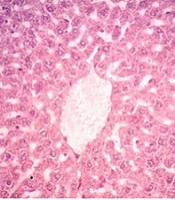 Jundishapur J Nat Pharm Prod